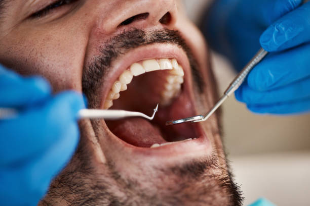 Best Urgent Tooth Repair  in Wauconda, IL